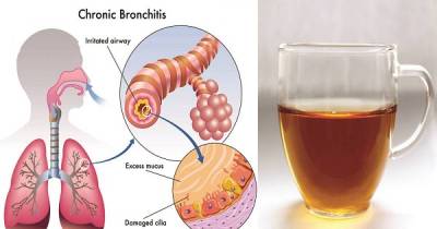 Remove Mucus From Your Lungs With This New, All-Natural Syrup!