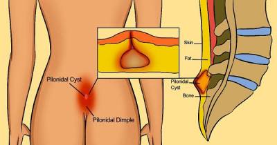 You Shouldn't Ignore This Underlying Cause For Pain In The Lower Back