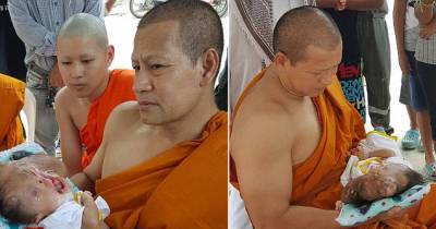 Severely Disabled Baby Girl Who Was Born Blind, Without A Skull Is Cared For By Monks!