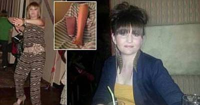 Woman Lost Her Leg After Getting A Blister From Dancing In Her High Heels