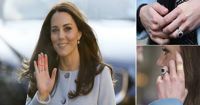 Why Does Clumsy Kate Always Have A Band-Aid On Her Hands?