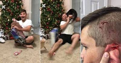 Jerk Cat Attacked An Overly Excited Man While He Was Opening Christmas Gift!