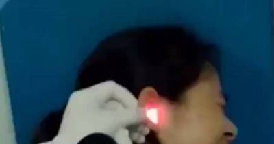 She Was Complaining Of Pain In Her Ear. When Doctors Checked It, They Saw The Shocking Problem.