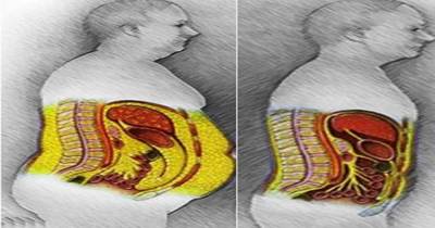 48-Hour Weekend Liver, Colon And Kidney Detox That Will Remove All Toxins And Fat From Your Body