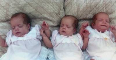Triplets Remarkably Survive Fire, Burn Scars And Loss Of Parents