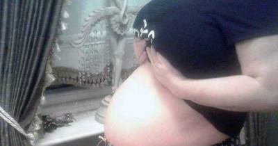 This Woman Looked Pregnant For 3 Years