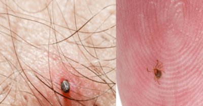 Here Is The Right Way To Remove A Tick