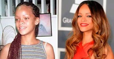 15 Most Unrecognizable Celebrities Post Fame