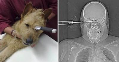 Unbelievable Stories Of Surviving Amazing Stabbing Wounds
