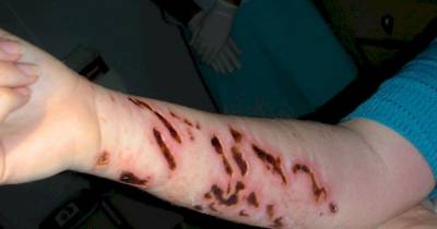 Creepy Reasons To Stay Far Away From Australia