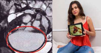 While Being Intimate With Her Husband She Felt Something Move Inside Her. What Doctors Pull Out? OMG