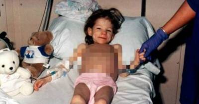 The 25-Pound 8-Year-Old: Little Girl Mercilessly Tortured By Her Own Parents For Years