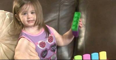 This Child, Suffering From A Rare Genetic Condition, Is Known As The &lsquo;Baby Hulk&rsquo;