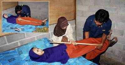 Indonesian Woman Suffering Rare Disease That Has Made Her Unable To Bend Over For The Last 10 Years