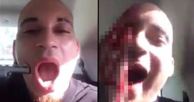 Man Films Shooting Himself In The Face Because Social Media Has Gone Too Far