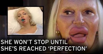 People Who Won't Stop Having Plastic Surgery