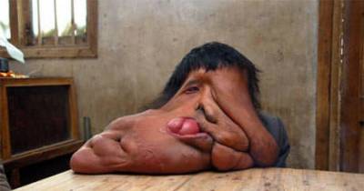 Terrifying Medical Conditions You&rsquo;ve Never Heard Of.