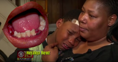 This Mom Is Furious At School Who Pulled Out Her Child&rsquo;s Teeth Without Permission