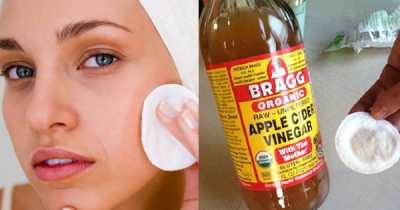 Here Is What Happens When You Wash Your Face With Apple Cider Vinegar