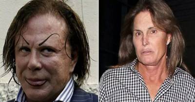 Male Celebs Who Completely Botched Their Faces
