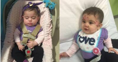 Baby Was Covered In Cuts, And Every Parent Needs To Know Why.