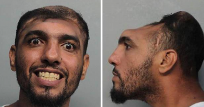 This Guy Has Only Half Of His Head But He Doesn't Let That Slow Him Down