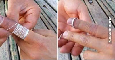 How To Remove A Ring That Is Stuck On Your Finger