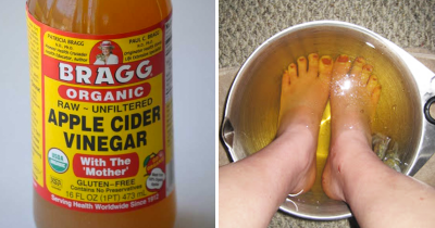 If You Soak Your Feet In Apple Cider Vinegar, This Is What Happens... That&rsquo;s Amazing!