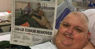 130-Pound Tumor Was Removed From A Man Who Was Told That He Was Just Fat