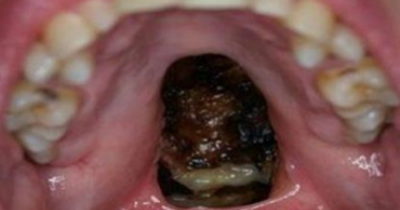 Dentist Dismayed By What He Sees Inside Man&rsquo;s Mouth