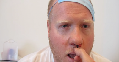Nurse Asks Him To Hold His Breath And Pulls This Out&mdash;Try Not To Scream