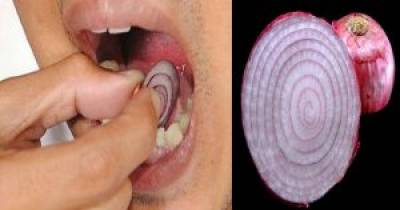 Put A Slice Of Black Onion On Your Tooth And Let It Sit For 15 Minutes, Here&rsquo;s What Happens!
