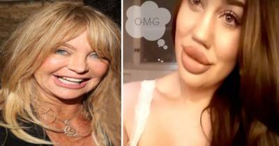 Terrifying Lip Filler Fails