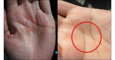 Mystery Behind The Letter X On Your Palm Revealed