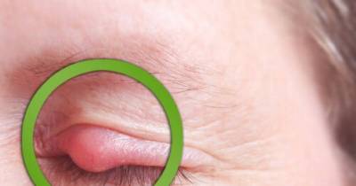 6 Gross Things That Happen To Your Skin When You Sleep In Your Makeup