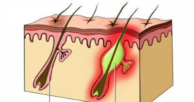 5 Gross Things That Happen When You Don't Change Your Razor