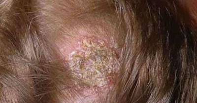 7 Gross Things That Sometimes Happen When You Bleach Your Hair