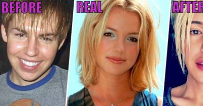 How Far Would You Go To Look Like Your Favorite Star? This Obsessed Fan Went Too Far!