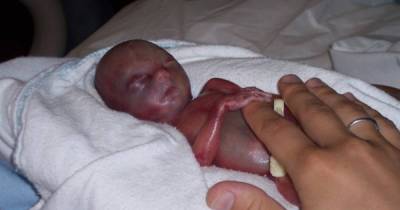 Pregnant Teens Are Doing This Horrible Thing To Keep Their Babies Small