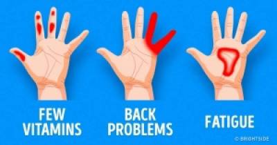 7 Important Things Your Hands Are Trying To Tell You About Your Health