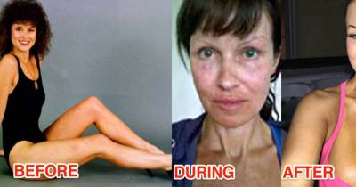 Plastic Surgery Obsessed Mother Spends Over $100k To Be Attractive To Young Guys.