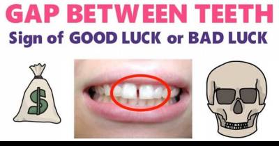 Do You Have Gap Between Teeth? Is It A Sign Of Good Luck Or Bad Luck? Here&rsquo;s What It Means.
