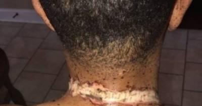 Omg! Man Fell Asleep Charging His iPhone And Had To The Most Shocking &ldquo;Alarm&rdquo; Of His Life
