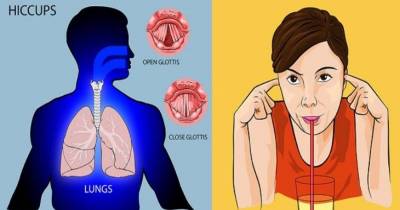 8 Super Easy Ways To Stop Your Hiccups