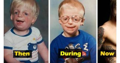 He Was Abandoned By His Parents For Being Too Ugly But The Story Has Another Unpleasant Twist