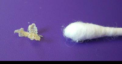 Your Earwax Is An Alarm Signal, 7 Things It Will Tell You About Your Health