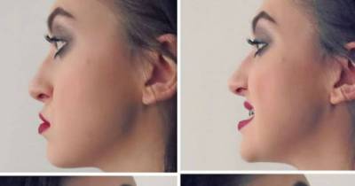 What Your Chin Can Say About Your Health