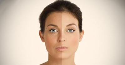 How Does Baking Soda Help With Your Face?