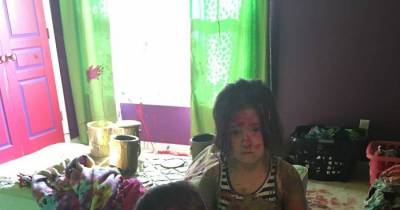 Shocking Images Of What Can Happen When You Leave Your Little Ones Alone