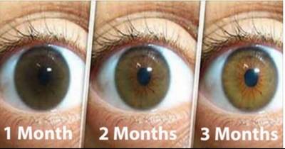 Natural Remedy For Cleaning Your Eyes And Improving Vision In Only 3 Months